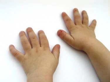 قضم الأظافر عند الأطفال