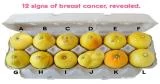 أعراض سرطان الثدى وكيفية الفحص الذاتى