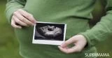 تعرفي على تكوين جنينك أسبوعًا بأسبوع