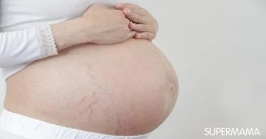 كريمات علاج تمدد الجلد للحامل