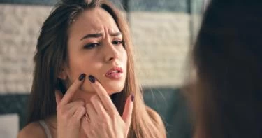 جفاف البشرة في الشتاء