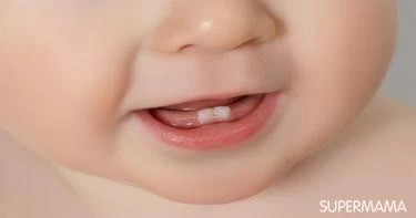 تأخر التسنين عند الأطفال