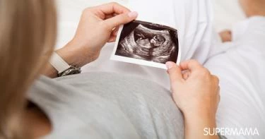 إخفاء خبر الحمل