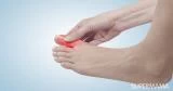 ازرقاق الأطراف وآلامها.. الأسباب والعلاج