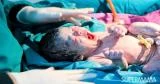 مسح المولود بالسائل المهبلي بعد القيصرية.. هل هذا صحي؟