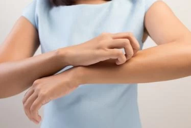 علاج الحكه بعد ازالة الشعر