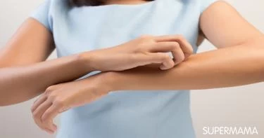 علاج الحكه بعد ازالة الشعر