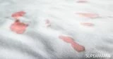 إزالة بقع الدم