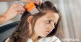وصفة طبيعية لعلاج القمل: اصنعيها بنفسكِ