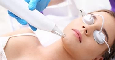 أفضل عيادات إزالة الشعر بالليزر