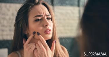 سبب ظهور حبوب في الوجه فجأة