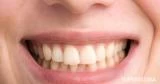 7 أخطاء يومية تجعل أسنانك صفراء