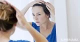 ما فوائد البيوتين في علاج تساقط شعري؟