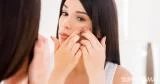 6 حيل للتخلص من البثور السوداء في وجهك